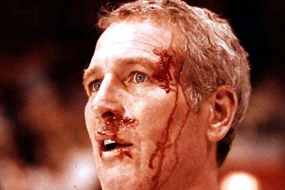 Paul Newman ensangrentado luego de una violenta jugada