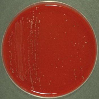 Científicos del INTA y de la UBA identificaron genes de microorganismos que degradan la celulosa.