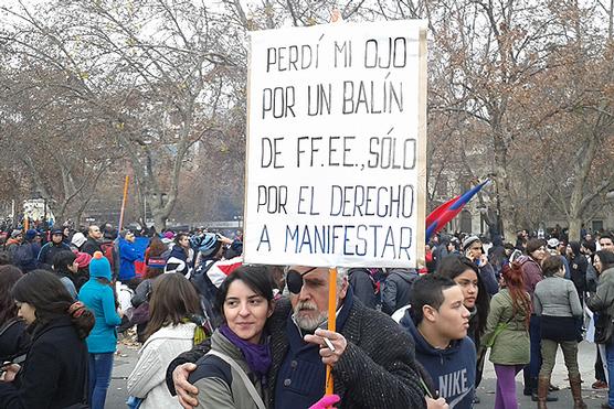 Un manifestante que perdió un ojo por protestar