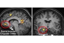 Profundizan conocimientos sobre el cerebro