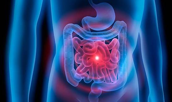 Enfermedades Inflamatorias Intestinales