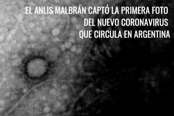 Coronavirus