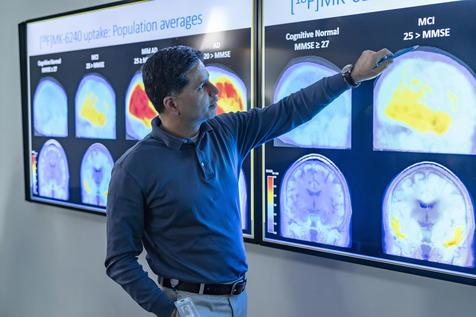 Desde Chile llega un nuevo modo de diagnosticar y tratar el Alzheimer (foto: ANSA)