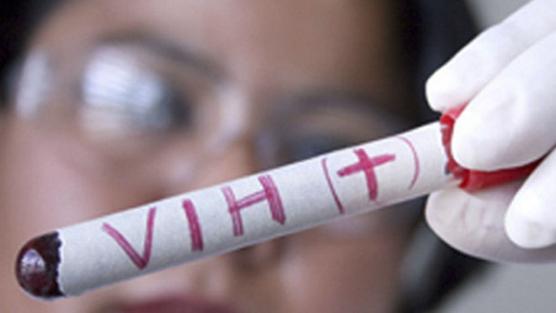 Muestra de sangre para estudio HIV-VIH-SIDA-AIDS