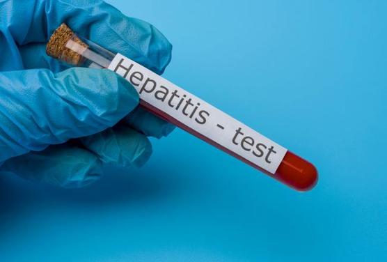 Hepatitis